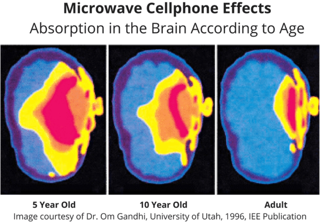 emf-effects-children-brain